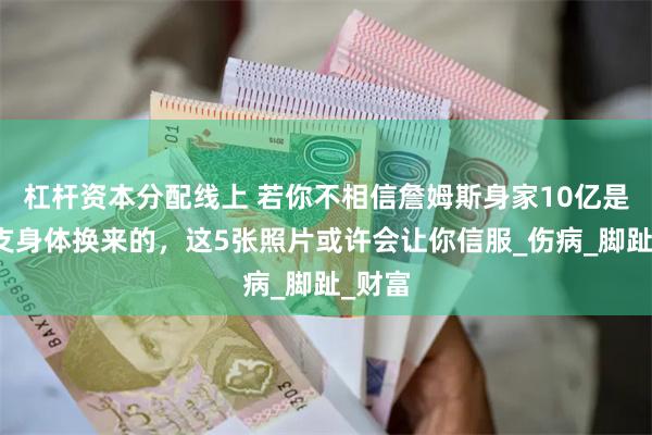 杠杆资本分配线上 若你不相信詹姆斯身家10亿是靠透支身体换来的，这5张照片或许会让你信服_伤病_脚趾_财富