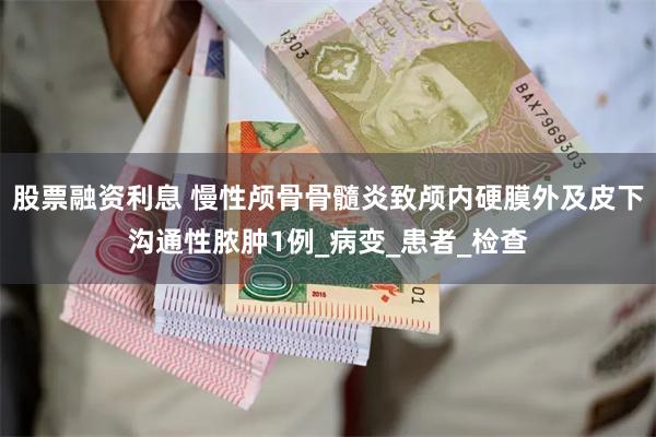 股票融资利息 慢性颅骨骨髓炎致颅内硬膜外及皮下沟通性脓肿1例_病变_患者_检查